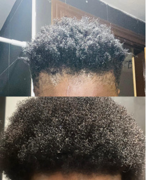 Huile Anti-Chute & Repousse | Tôlaa - Booster de Croissance